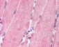 NRG1 / Heregulin / Neuregulin Antibody (N-Terminus)